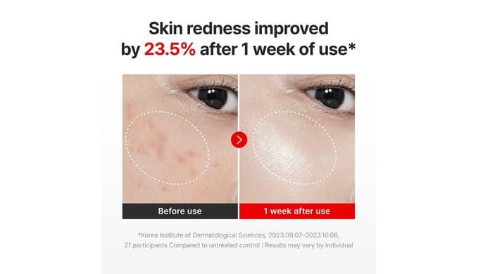 CENTELLIAN 24 Madeca Cream Time Reverse, TECA Anti-Aging Moisturizer thumbnail 3