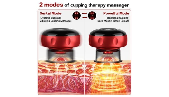 2 Pack Cupping Set, 7-in-1 Smart Cupping Therapy Massager. Red Light Cupping Therapy Set with 2 Modes for Targeted Muscle Soreness,Tighter Skin,Cupping Kit with 20 Levels Suction and Heat and Gua Sha thumbnail 3