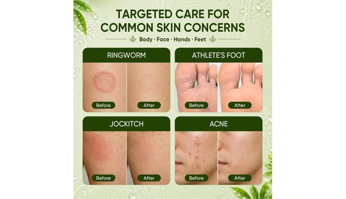 Tea Tree Soap Bar 3 Pack, Antifungal Tea Tree Oil Soap for Face & Body thumbnail 4